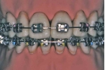 maruchimetal.jpg