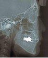 10035Cceph.jpg
