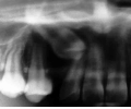 10099x0.jpg