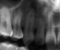 10099x3.jpg