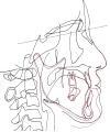 開咬セファロ顔重.jpg