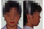 第8症例顔組写真B.jpg