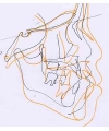 第8症例（重：全体）.jpg