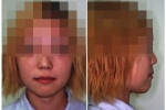 第8症例顔組写真C.jpg