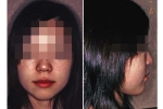 第8症例顔組写真D.jpg